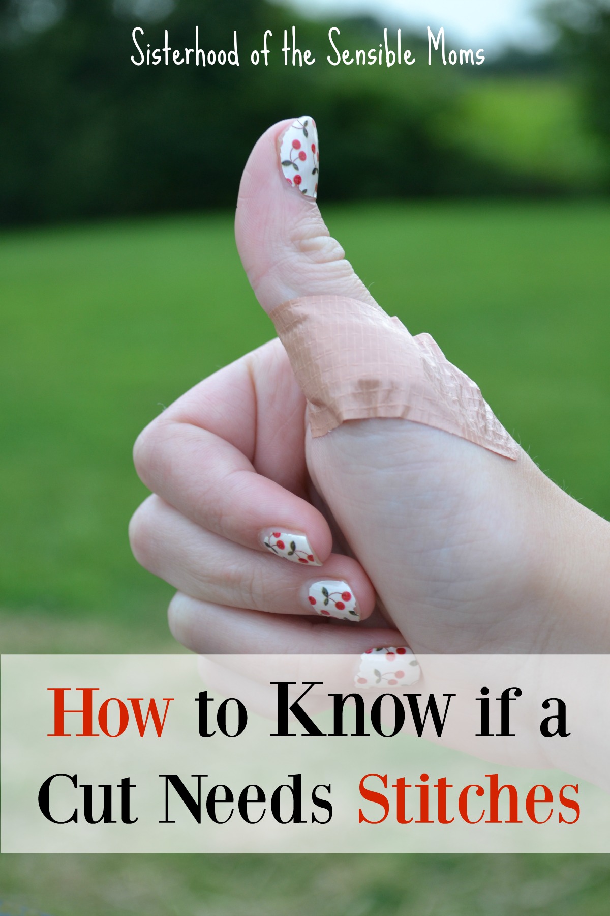 In a quandary about whether or not to head to urgent care? How to know if a cut needs stitches: a helpful guide to help you evaluate the situation. | Health | Parenting | Sisterhood of the Sensible Moms
