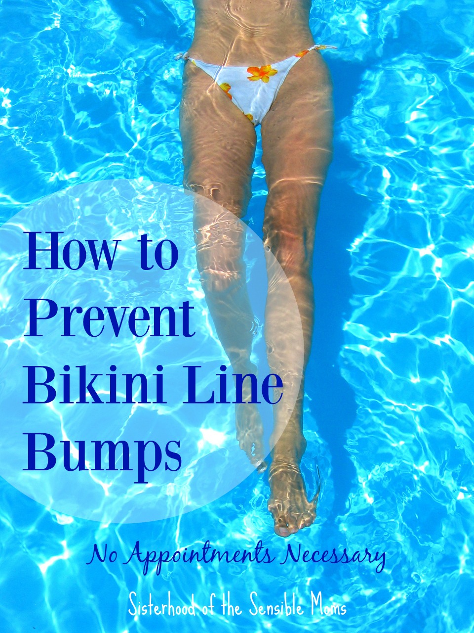 Get summer ready! How to Prevent Bikini Line Bumps. Have you tried everything to prevent bikini line bumps? Think again. You may not have tried this cheap, painless, and easy solution. | Sisterhood of the Sensible Moms