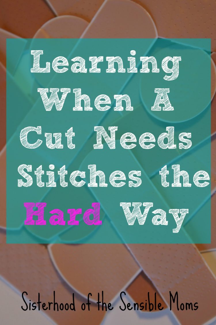 Keep your summer and kids safe by learning when a cut needs stitches | Sisterhood of the Sensible Moms